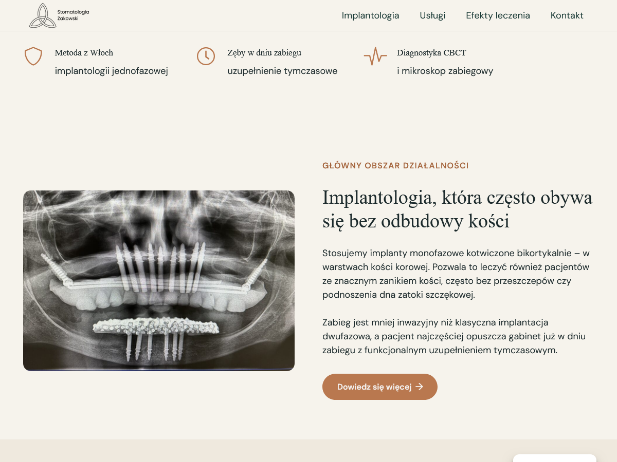 Stomatologia Żakowski - detal, np. galeria metamorfoz